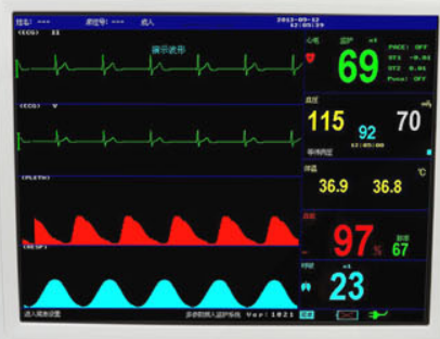 The data displayed by the electrocardiograph is okay, does it mean that the heart is okay?